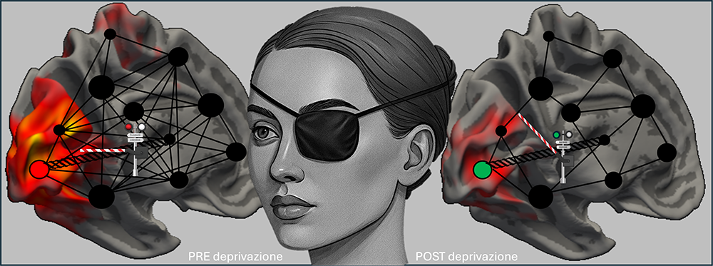 Scoperta sul potenziale plastico del cervello adulto